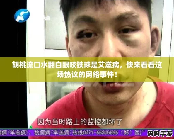 胡桃流口水翻白眼咬铁球是艾滋病，快来看看这场热议的网络事件！