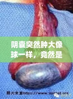 阴囊突然肿大像球一样，竟然是“内卷”生活的意外反应？