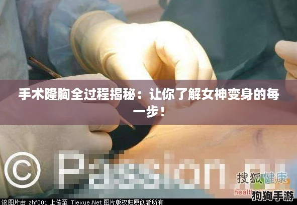 手术隆胸全过程揭秘:让你了解女神变身的每一步! 手术隆胸全过程揭秘:让你了解女神变身的每一步!