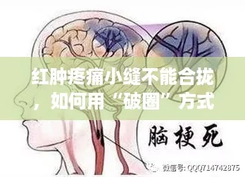 红肿疼痛小缝不能合拢,如何用“破圈”方式快速自救? 红肿疼痛小缝不能合拢,如何用“破圈”方式快速自救?