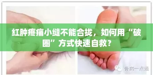 红肿疼痛小缝不能合拢,如何用“破圈”方式快速自救? 红肿疼痛小缝不能合拢,如何用“破圈”方式快速自救?