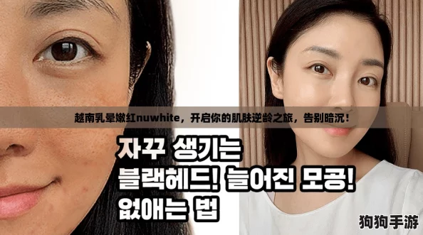 越南乳晕嫩红nuwhite，开启你的肌肤逆龄之旅，告别暗沉！