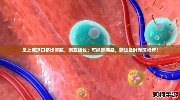 早上尿道口挤出黄脓，网友热议：可能是感染，建议及时就医检查！
