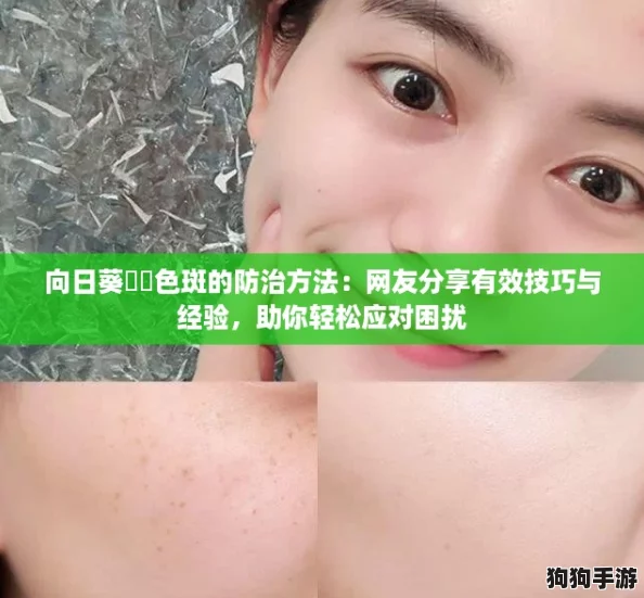 向日葵卍卍色斑的防治方法:网友分享有效技巧与经验,助你轻松应对困扰 向日葵卍卍色斑的防治方法:网友分享有效技巧与经验,助你轻松应对困扰