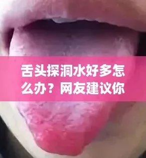 舌头探洞水好多怎么办？网友建议你试试这些简单有效的缓解方法！