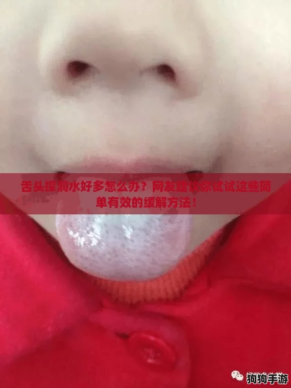 舌头探洞水好多怎么办?网友建议你试试这些简单有效的缓解方法! 舌头探洞水好多怎么办?网友建议你试试这些简单有效的缓解方法!
