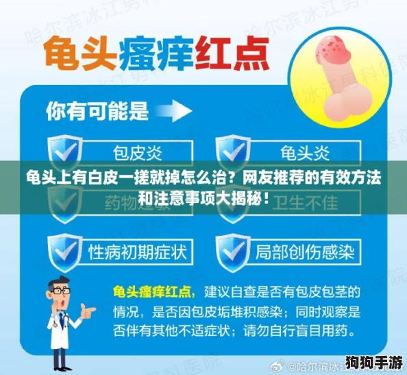 龟头上有白皮一搓就掉怎么治?网友推荐的有效方法和注意事项大揭秘! 龟头上有白皮一搓就掉怎么治?网友推荐的有效方法和注意事项大揭秘!