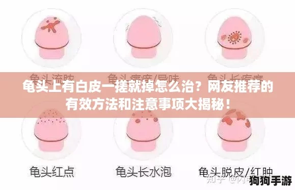 龟头上有白皮一搓就掉怎么治?网友推荐的有效方法和注意事项大揭秘! 龟头上有白皮一搓就掉怎么治?网友推荐的有效方法和注意事项大揭秘!