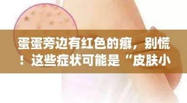 蛋蛋旁边有红色的癣，别慌！这些症状可能是“皮肤小怪兽”作祟