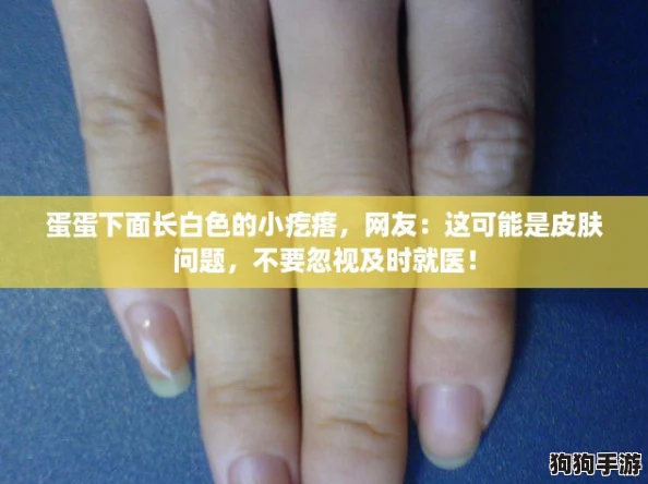 蛋蛋下面长白色的小疙瘩，网友：这可能是皮肤问题，不要忽视及时就医！
