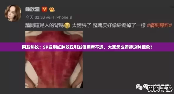 网友热议：SP发刷红肿双丘引发使用者不适，大家怎么看待这种现象？
