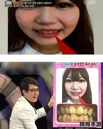 美女笑颜重生：牙齿修复通关秘籍，打造完美微笑新风尚！