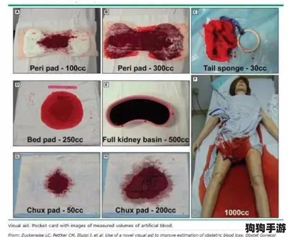 俄罗斯处破女出血39分钟，网友热议女性健康问题与急救措施的重要性