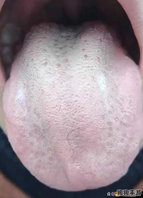 舌头在幽谷里滑来滑去怎么回事？解密奇异现象背后的科学与心理因素